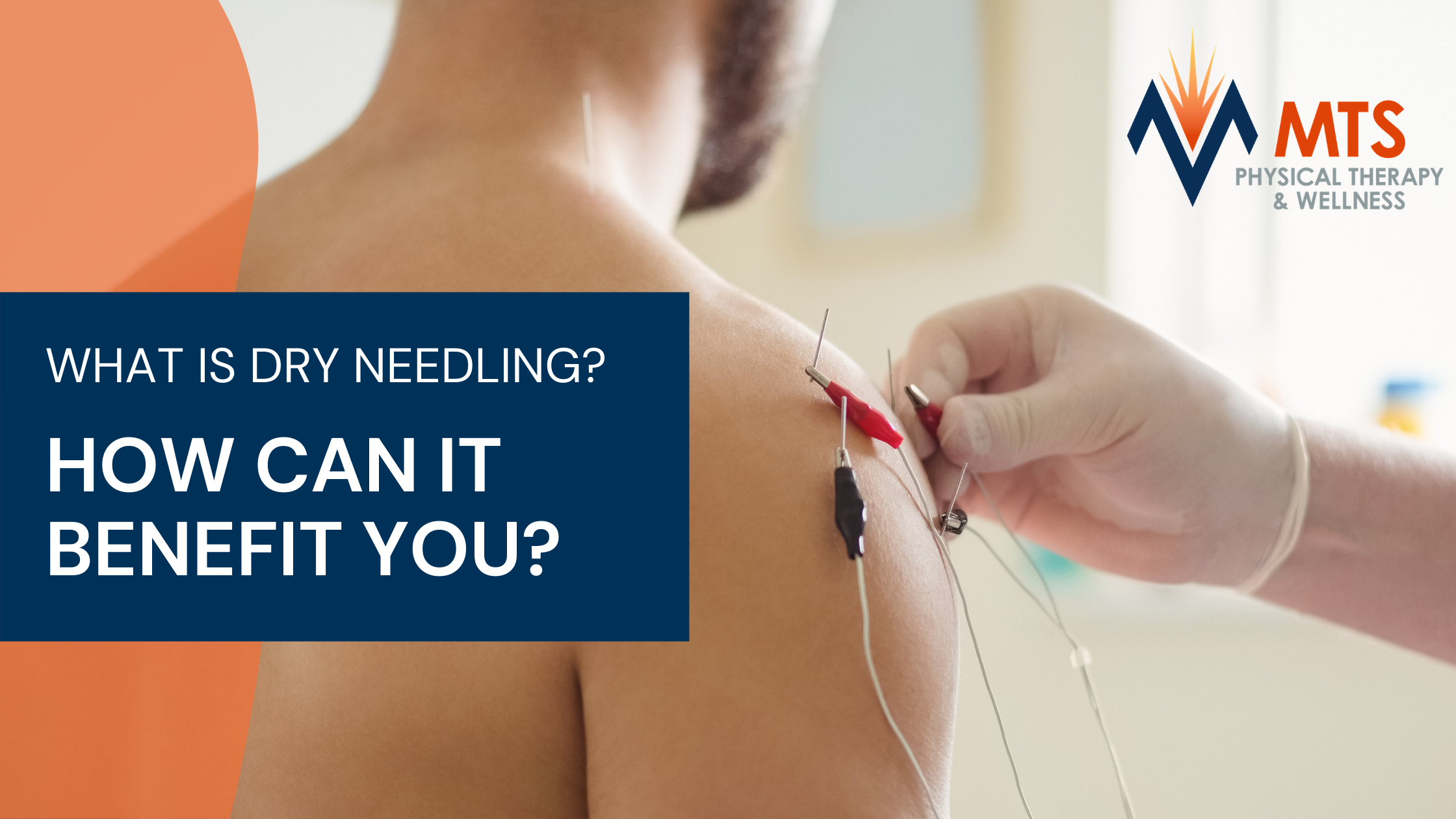 What is Dry Needling & How Can It Benefit You_